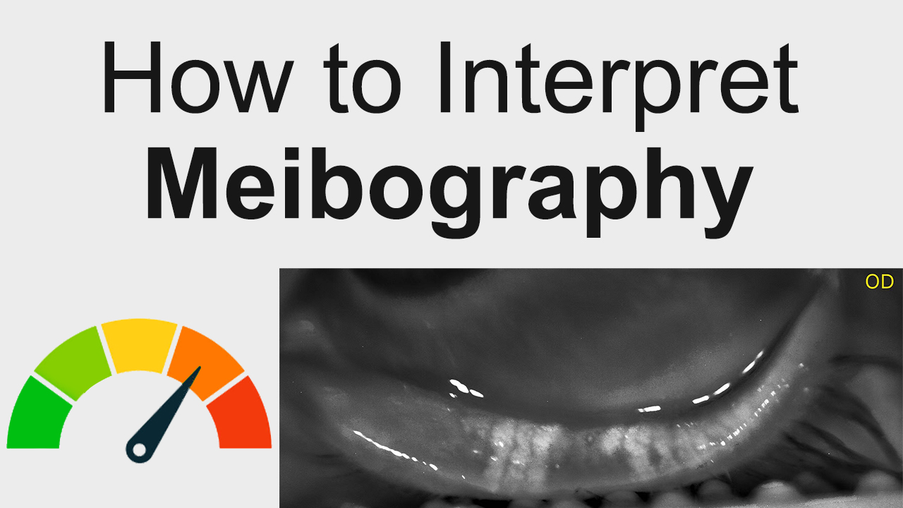 Wie man Meibographie interpretiert