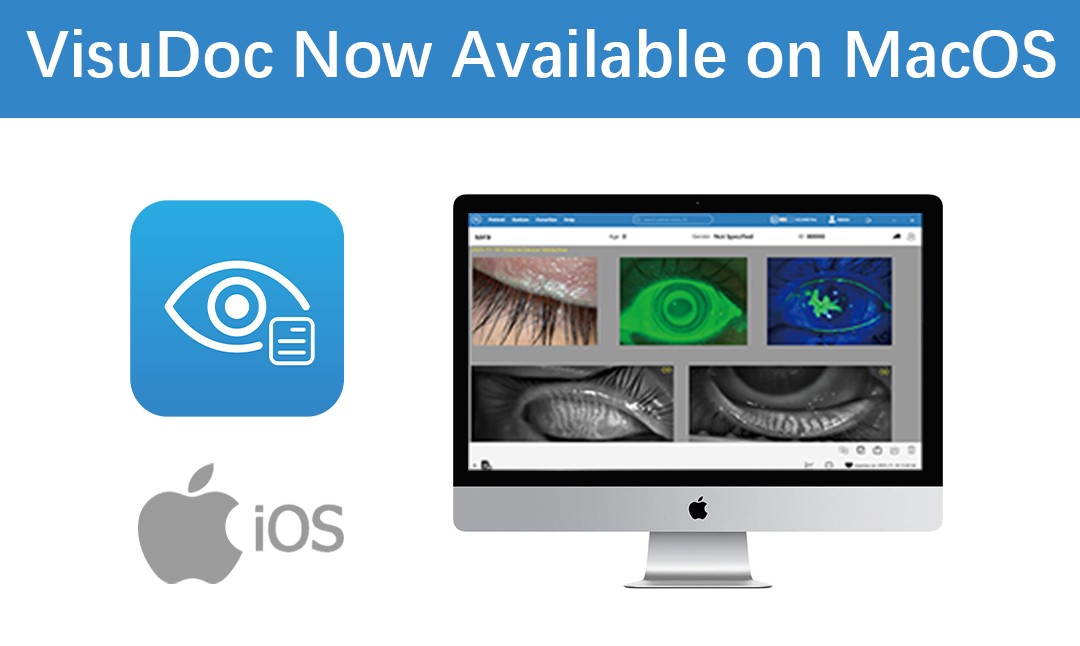 VisuDoc متوفر الآن على نظام MacOS