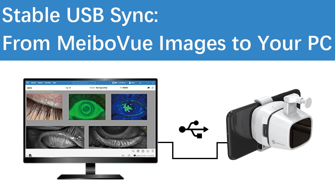 يدعم MeiboVue الآن مزامنة كابل USB مع VisuDoc