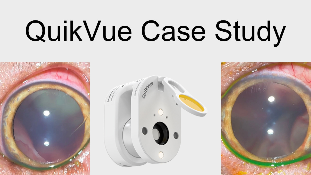 QuikVue Vet Case Share - انفصال الشبكية