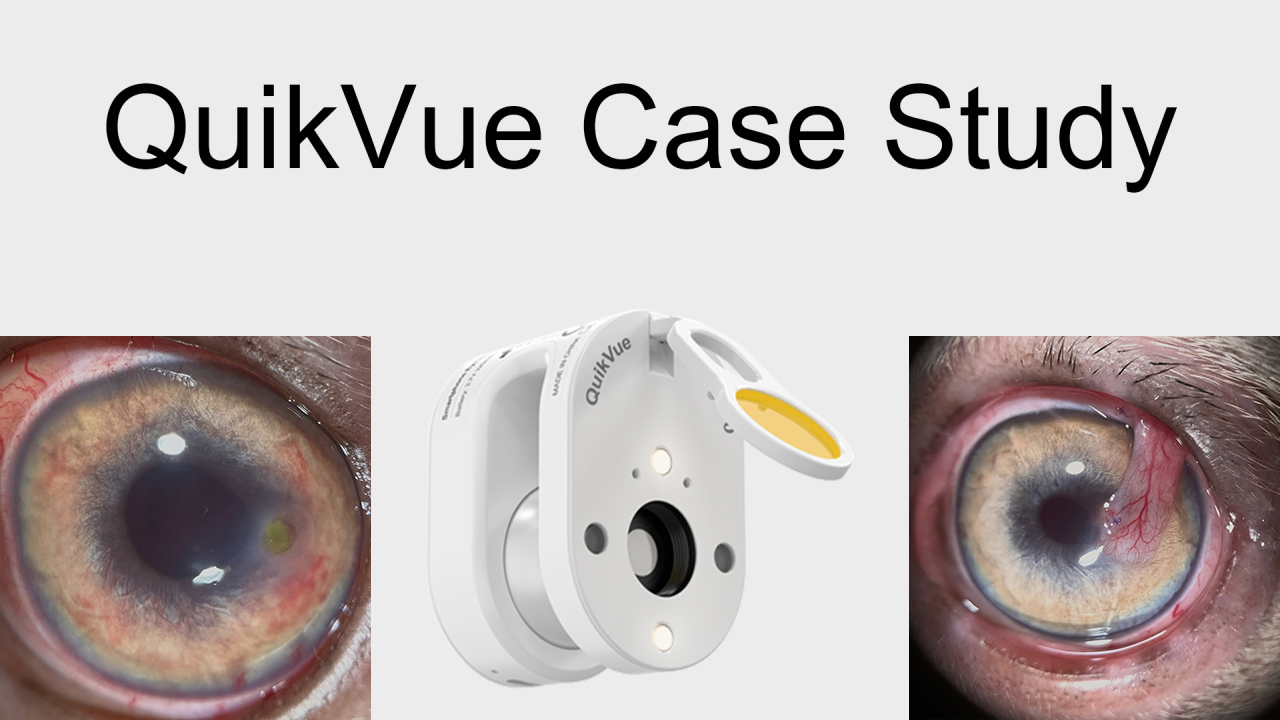 مشاركة حالة QuikVue Vet - طعم الملتحمة