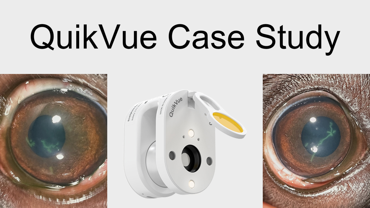 QuikVue Vet Case Share - تقرح القرنية الجذعية