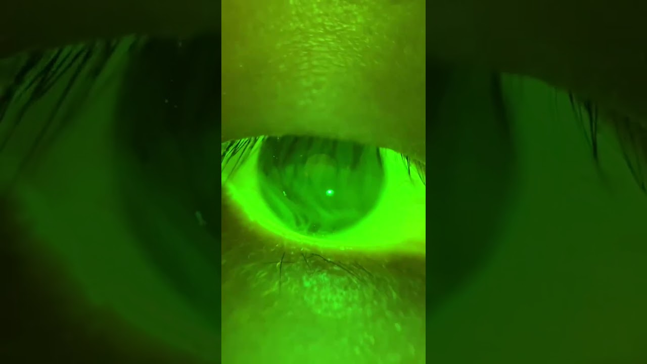 Tear Film Check by QuikVue 