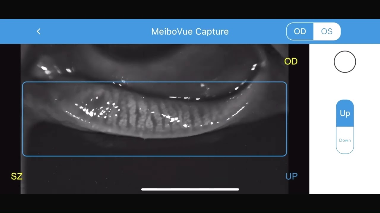 MeiboVue Aperçu de la vidéo en direct