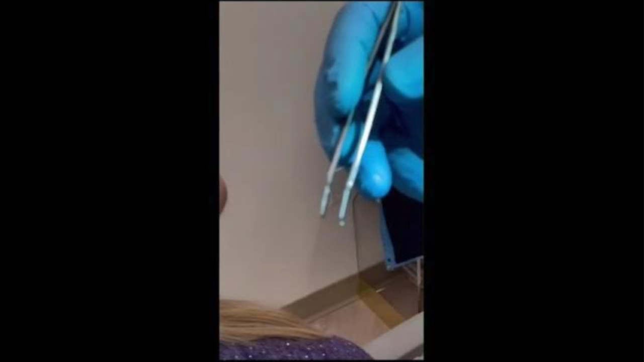 Vidéo de fonctionnement de l'iExpressor par le Dr Bruce Dornn