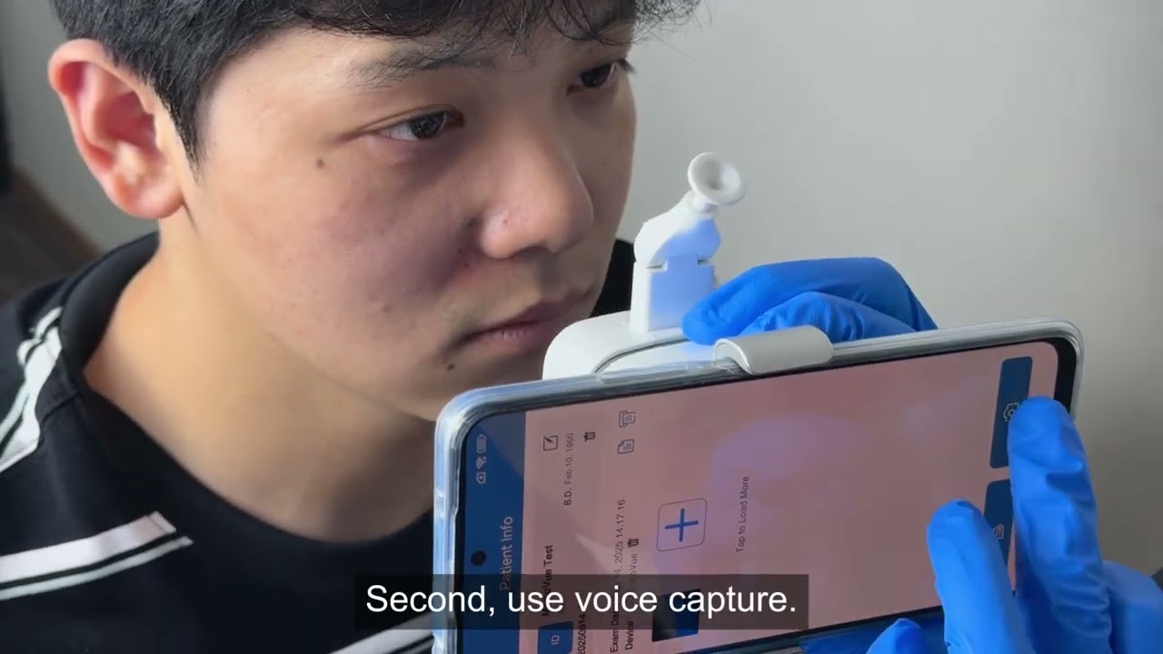 How to Capture Clear Meibomian Gland Images with MeiboVue | Meibography Tutorial