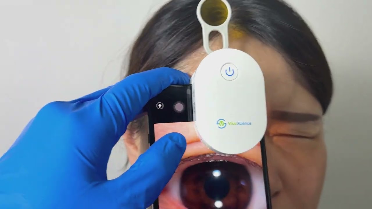 Quick Operation Demo for QuikVue
