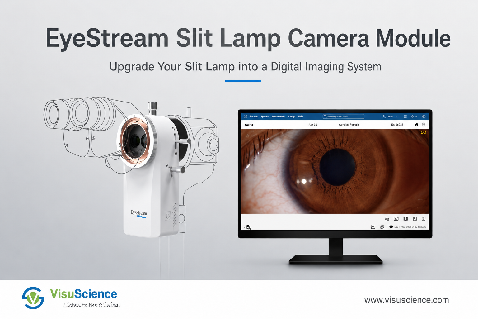Upgrade Your Slit Lamp to Digital Imaging System
