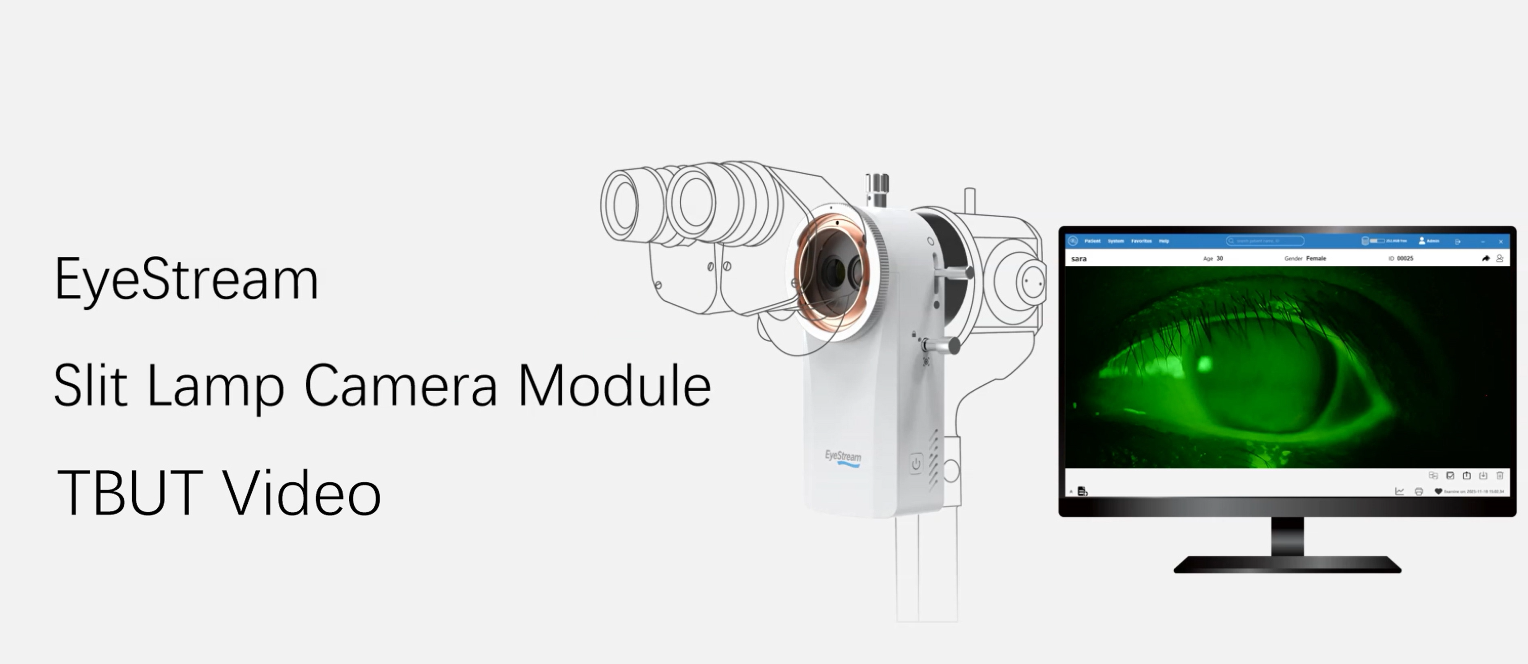 Slit-Lamp TBUT: Capture, Measure, and Track Trends With EyeStream and VisuDoc