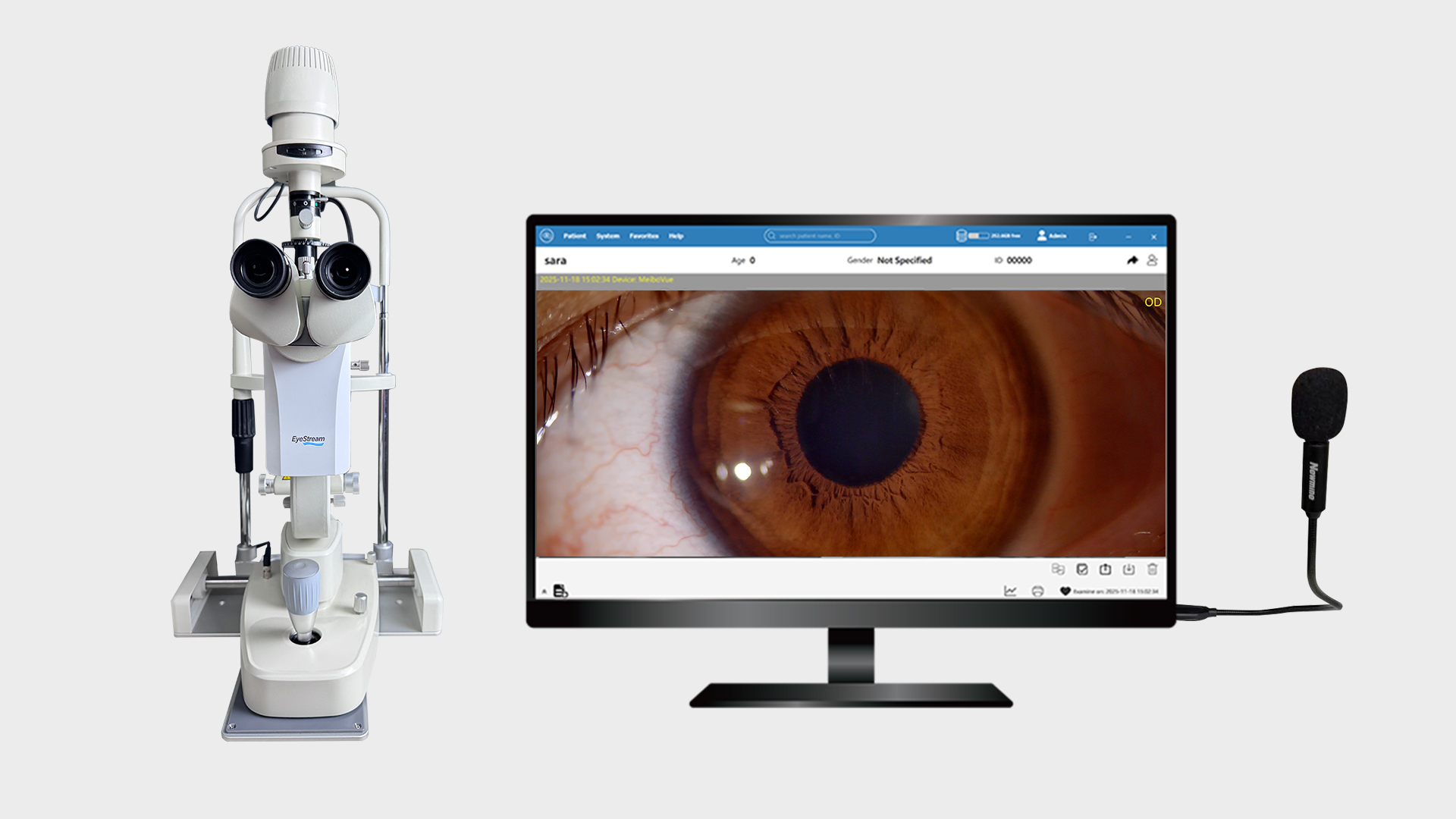 How to Check EyeStream Compatibility for Slit lamps