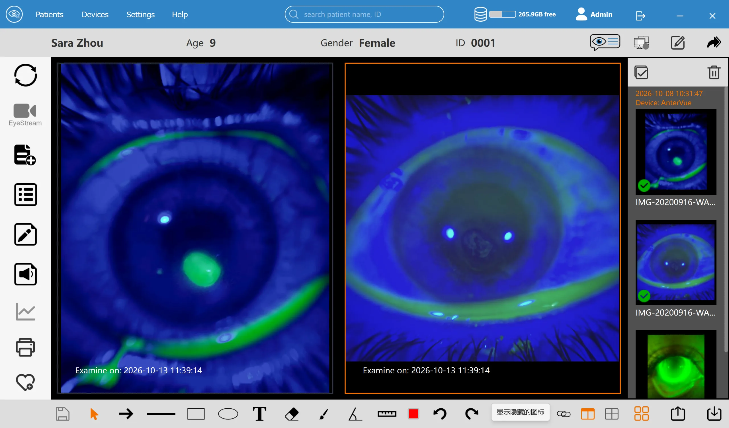 VisuDoc comparing patient eye images across visits side by side