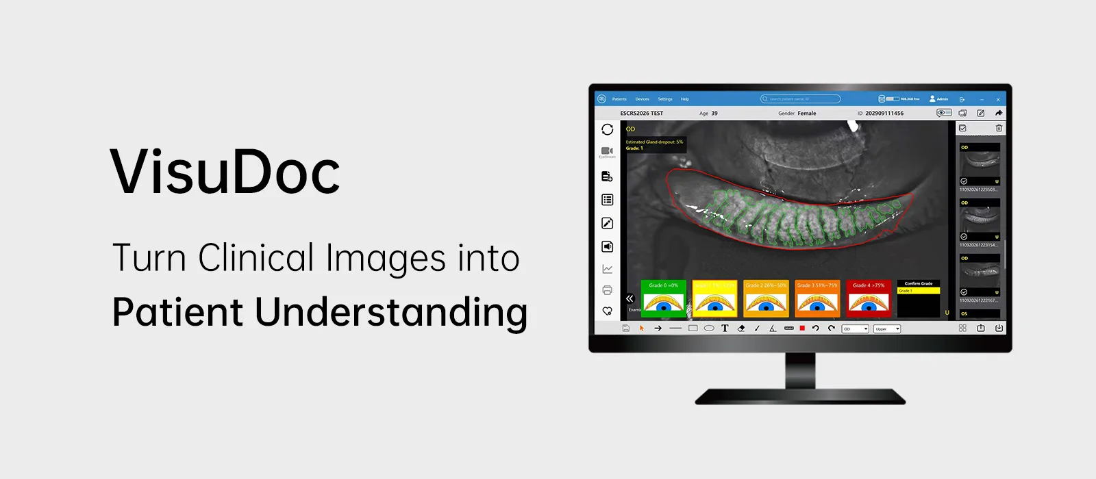 VisuDoc Ophthalmic Case Management Software